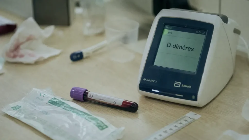 D dimeres eleves et inflammation : prise de sang et résultat laboratoire